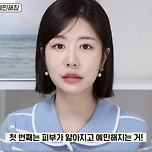 괄사 부작용 후기 이미지