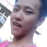 지디병에 걸렸다는 남자의 스타일 변화.jpg 이미지