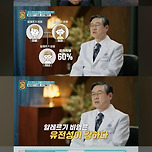 알레르기 비염의 유전 확률 이미지