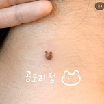 튀어나온 점 곰돌이로 만드는 타투 이미지