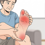 요산 수치 높을 때 통풍 초기증상 주의 이미지