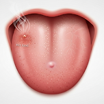 혓바닥 끝 통증과 따가움의 원인, 불편한 혀 통증의 이유 이미지