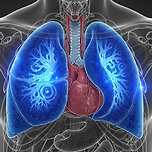 폐에 물이 찬 경우의 증상, 원인, 합병증 이미지