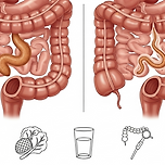 변이 가늘어지는 이유, 얇은 변(가는변)이 생기는 원인 이미지