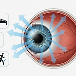 눈 안압 낮추는 법과 안압이 높은 이유, 효과적인 관리 방법 이미지