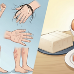 단백질 부족 시 나타나는 5가지 신호 이미지