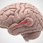 뇌동맥류 초기증상과 발병 원인, 일상에서 주의할 점 이미지
