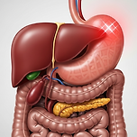 갑자기 윗배가 아프고 콕콕 쑤실 때 원인 이미지