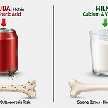 탄산음료가 뼈 건강에 미치는 영향 이미지