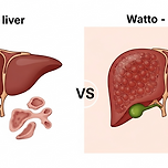 알코올 분해 속도와 간 건강 이미지