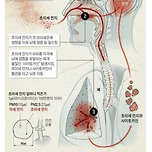 초미세 먼지, 뇌 어떻게 공격하나 이미지