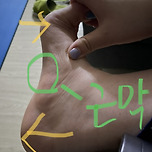 족저근막염인데 집에 마사지건있다? 들어와 이미지