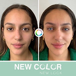 외국에서 한다는 눈동자 색 바꾸는 수술 이미지