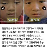 쌍꺼풀 성형수술 받은 일본 초등학생 이미지