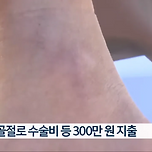 [뉴스] 인도 걷다가 다친 시민에 소송 건 청주시... 결국 '패소' 이미지