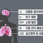 [정보] 미세먼지가 건강에 미치는 영향 이미지