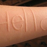 우리나라 5%가 가지고있다는 피부병 이미지