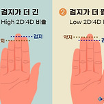 &#34;내가 대머리 될 상인가?&#34;...손가락 &#39;이것&#39; 보면 안다고? 이미지