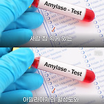 밥 냉장보관하면 저항성 전분 생겨서 혈당스파이크 막아주고 다이어트된다(?) 팩트체크 이미지