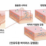 (약혐 주의) 사람 몸이 나무로 변한다면? 이미지