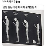 거북목의 최후 이미지