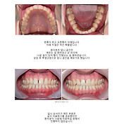 부/산/건/치