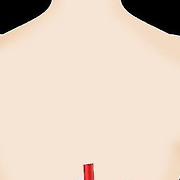 "만성 신부전 관련 35개 유전자 발견"