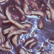 "팔팔 끊여 먹어도 신부전증 유발합니다" 60대가 건강 식품인 줄 알고 자주 먹는 음식