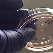 '미니 뇌' 제작 성공