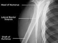 X-RAY(SCAPULAR-Y-V..