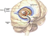 Parkinsonism..