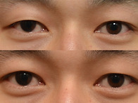 매몰사진 한번 올려봅니다..