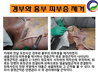 광경근막과 안면관리