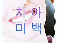 치과 치아미백 가..