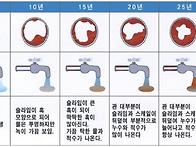 수도관 사용연령에 따른 ..