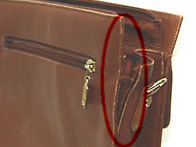 찧겨진 부위 복원..