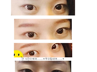 눈성형후 벌써 4주!!