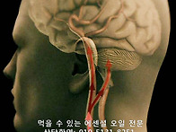 뇌혈관 문제