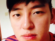 매몰+앞트임 속쌍눈성형 ..