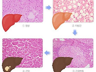 간이 건강해야 몸이 건강합..