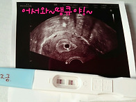 다시찾아온 선물!!&hearts;