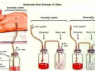 Chest Tube Inserti..