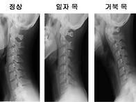 [스포츠칸] 쭉 빠진 목. ..