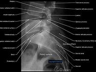 X-RAY(LUMBOSACRALJ..