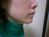 라르꼬발레노 화이트닝 세..