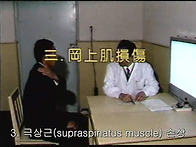09. 극상근 손상 (supr..