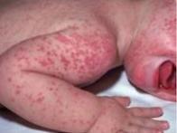 종합가시광선 탄소화광의 ..