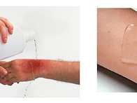 [왁싱전 주의 사항..