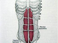 [Rectus Abdo..