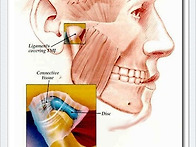 TMJ